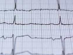 Vital signs: How medical hackers can now falsify patients’ records