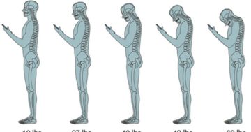 Sitting pretty: How poor posture can pose painful problems