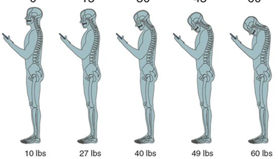 Sitting pretty: How poor posture can pose painful problems