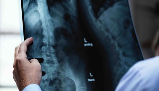 Scan alert: How an algorithm could help radiologists save lives