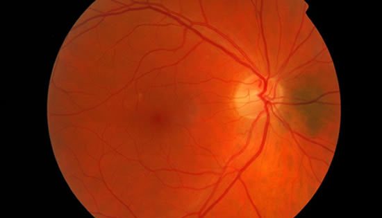 Second sight: How Australian breakthrough eye science leads the world