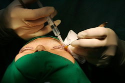 Facing up to cosmetic surgery risk