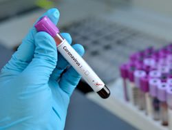 Australia ‘prepared for virus threat’