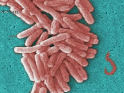 Hot weather brings Legionnaires risk