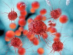 Cell-based immunotherapy shows promise against melanoma