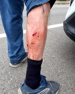 Electric meter readers bite back at dogs