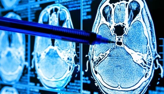 AI’s role in precision medicine