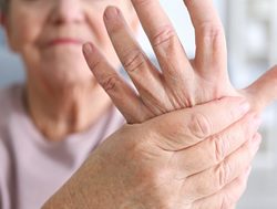 Advancing rheumatoid arthritis treatment for women