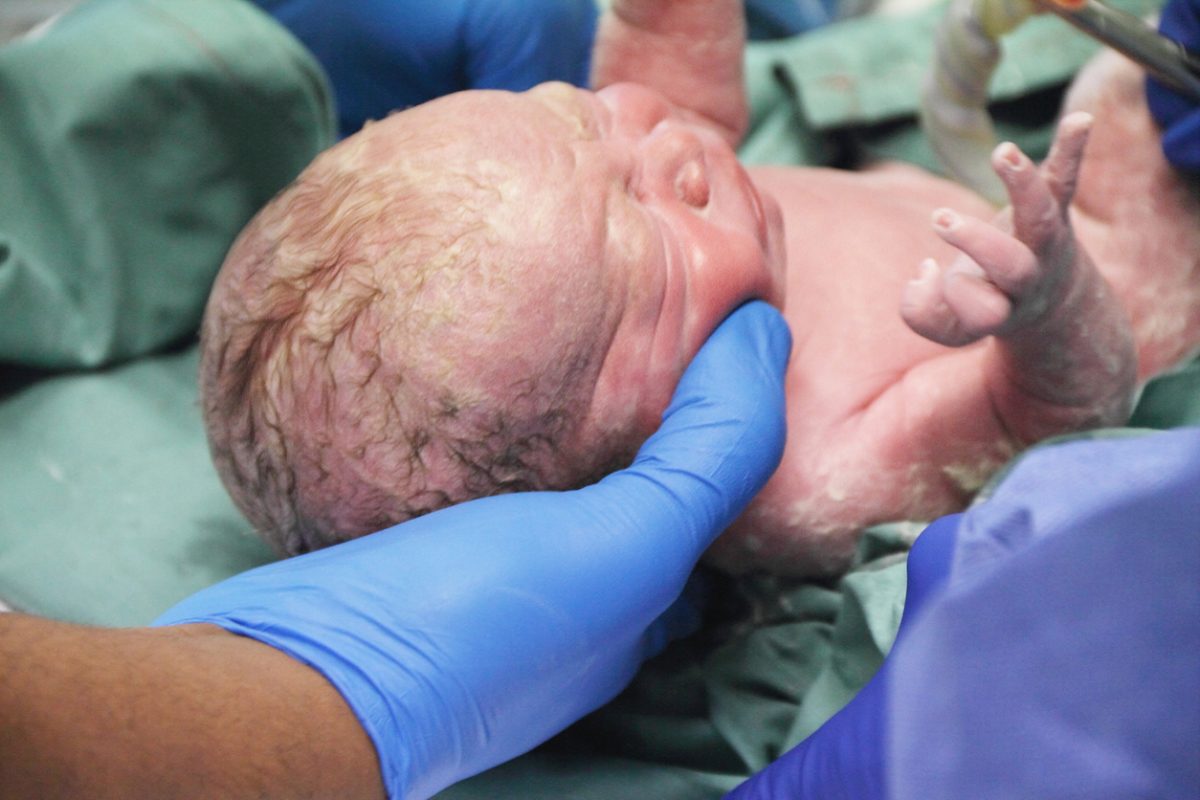 Doctors hold a newborn baby.